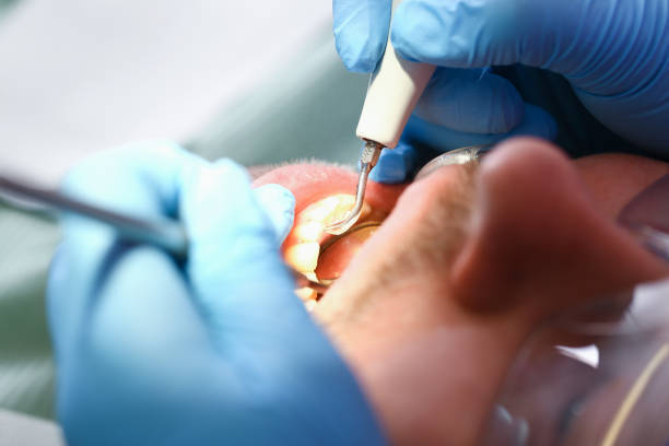 Best Knocked-Out Tooth Emergency  in Loudon, TN