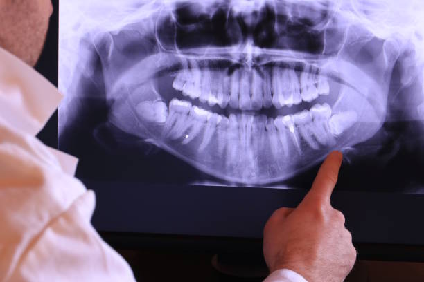 Best Emergency Tooth Extraction  in Loudon, TN