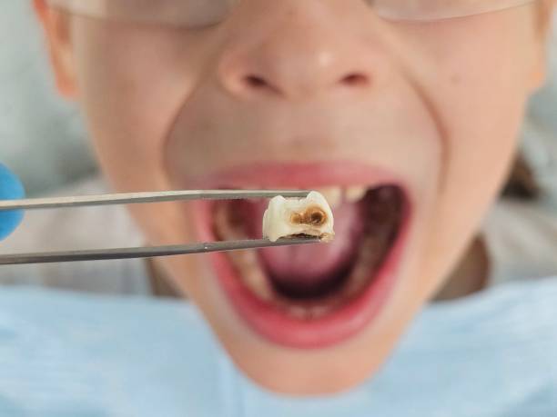 Best Broken Tooth Emergency  in Loudon, TN